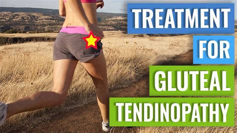 Treatment for Gluteal Tendinopathy - YouTube