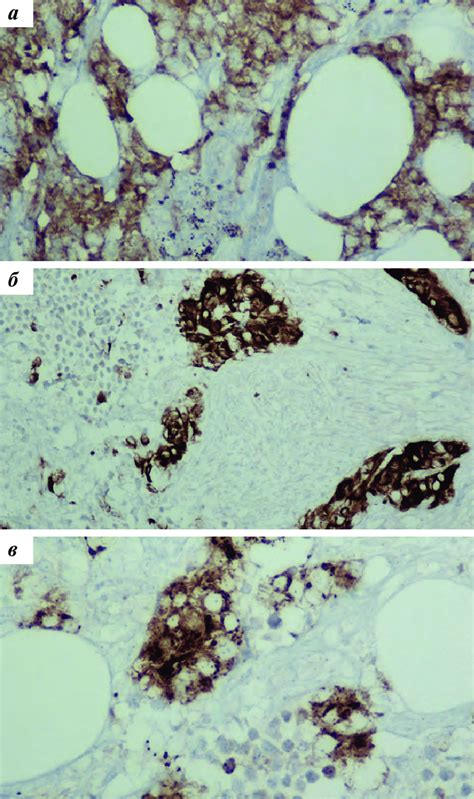 Immunohistochemical analysis: a -immunohistochemistry showed expression... | Download Scientific ...