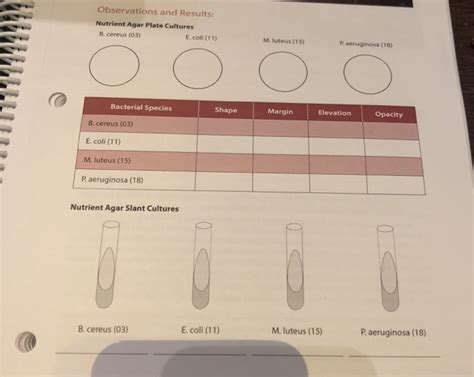 Solved Observations and Results: Nutrient Agar Plate | Chegg.com