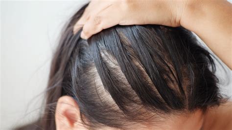 What Causes Hair Loss in Women? Causes & Treatments | Philip Kingsley