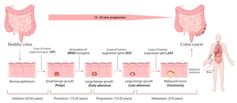 Colorectal Cancer Progression