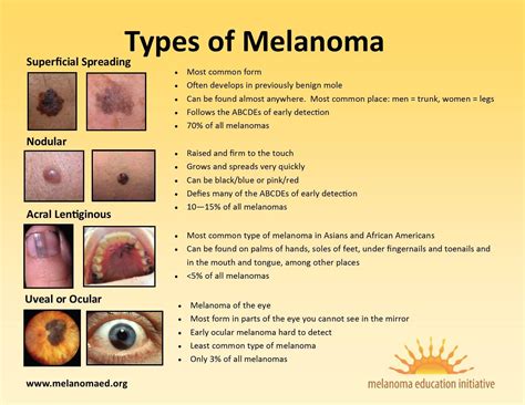 Melanoma Vs Non Melanoma