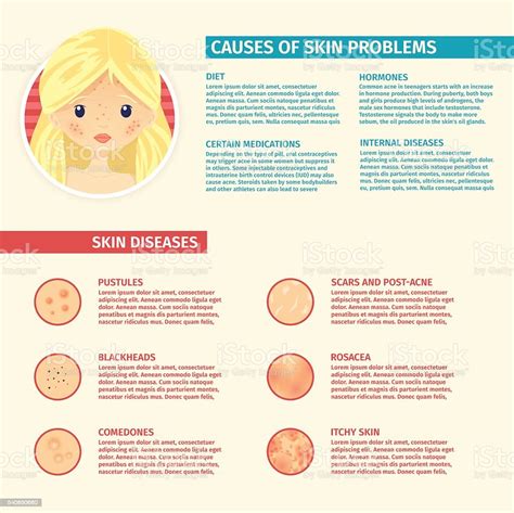 Infographics Of Skin Problems The Causes Of Problem Skin Stock ...