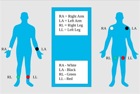 Electrocardiogram (ECG) | Concise Medical Knowledge