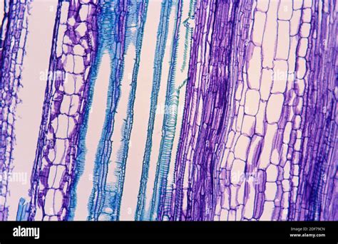 Phloem Tissue High Resolution Stock Photography and Images - Alamy