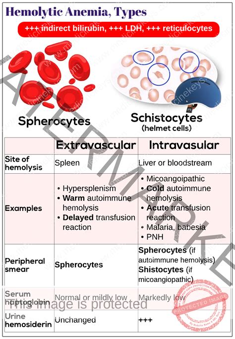 Hemolytic Anemia Types Causes Symptoms And Treatment | The Best Porn Website