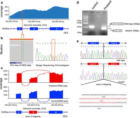 Identification of the splice site mutation and expression analysis of... | Download Scientific ...