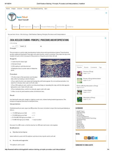 Ziehl Neelsen Staining -Principle, Procedure and Interpretations ...