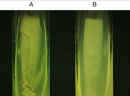 Cetrimide Agar: Composition, Preparation, Uses • Microbe Online