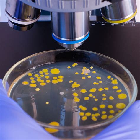 Heterotrophic Plate Count (HPC) Test – Oahu Lab Testing and Compliance LLC