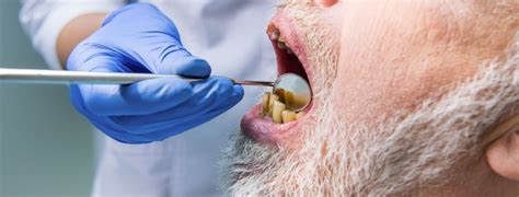 How Bad Teeth Affect Health in Pleasanton, CA | Gateway Dental Care