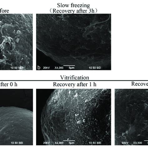 The influence of two freezing methods on perivitelline space and... | Download Scientific Diagram