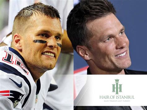 Jan Brady Hair