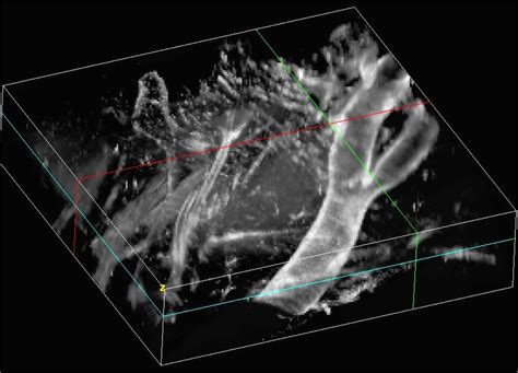 First 3D image from the Bessel Beam - Elegant Mind Club at UCLA