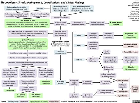 Hypovolemic Shock | Calgary Guide