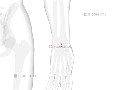 Left lunate | BioDigital Anatomy