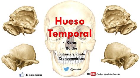 Partes Del Hueso Temporal