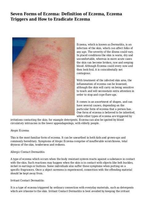 Seven Forms of Eczema: Definition of Eczema, Eczema Triggers and How to Eradicate Eczema