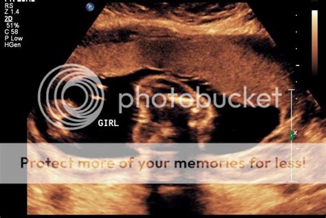 22 week ultrasound pics! - BabyCenter