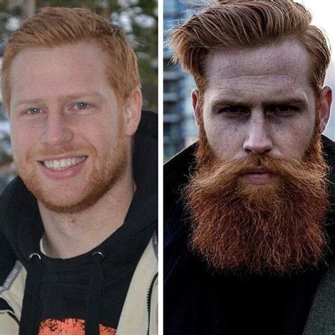 45 Amazing Beard Before and After Transformation Photos