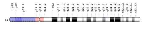 Multisuture craniosynostosis: unusual in chromosome 14q32 del