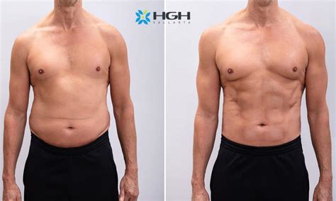 Real-Life HGH Before and After Results | HGH Vallarta Clinic