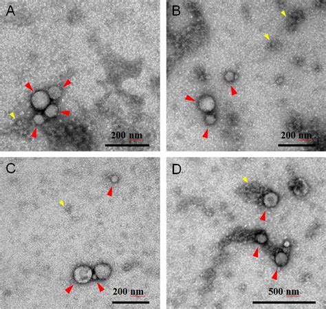 Representative electron microscopy negative staining images of pooled... | Download Scientific ...