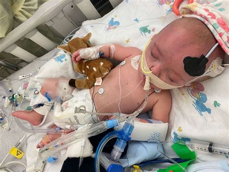 Mom shares dangers of RSV as 7-month-old is hospitalized - ABC News