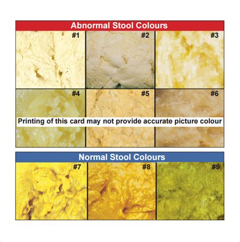 Stool Color Change Chart