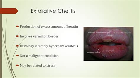 Diseases of lips & tongue