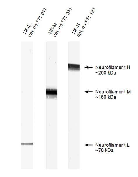 Neurofilaments