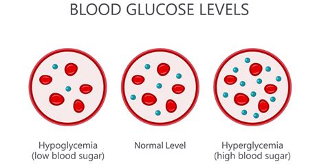 Hypoglycemia and Hyperglycemia: Difference, Causes, and Prevention