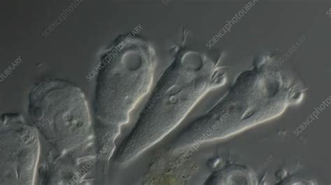 Epistylis ciliates, light microscopy - Stock Video Clip - K005/7406 - Science Photo Library