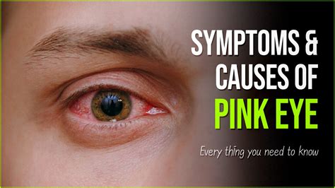 Pink Eye Symptoms: Causes And Treatment of Conjunctiva