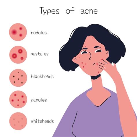 Premium Vector | Types of acne diagram