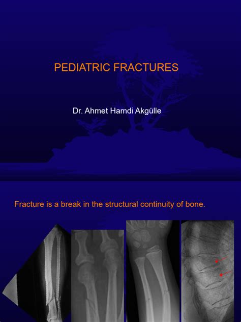 Pediatric Fractures | PDF | Bone | Surgical Specialties