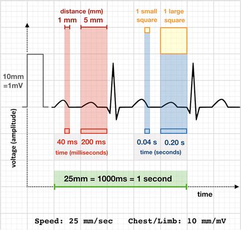 Ecg Interpretation