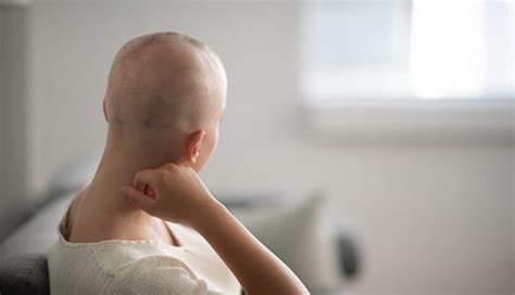 Hair loss after chemotherapy: 10 things to know | MD Anderson Cancer Center