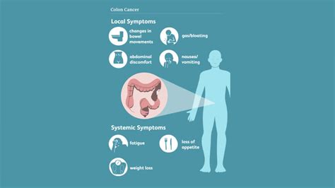 What Is Colorectal Cancer And What Are Its Symptoms, Causes, And Treatment?