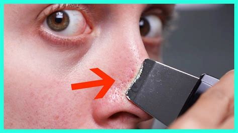 How To Clean Out Nose Pores At Home - Grizzbye