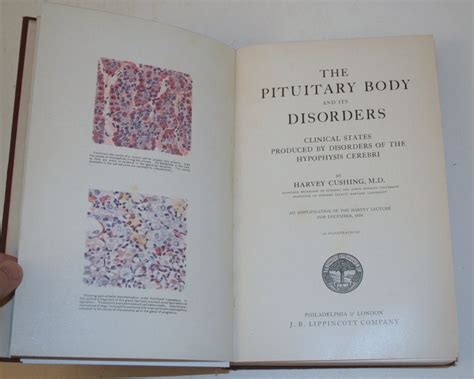 The Pituitary Body and Its Disorders : Clinical States produced by Disorders of the Hypophysis ...