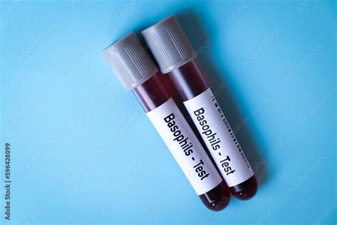 Basophils Test, blood sample to analyze in the laboratory Stock Photo | Adobe Stock