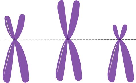 Aneuploidy | What is, definition, causes, types, risk, treatment, pregnancy