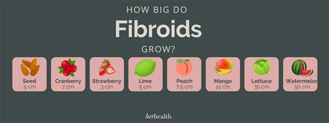 Fibroid and UFE Frequently Asked Questions