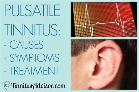 Pulsatile Tinnitus - Causes, Symptoms and Treatment