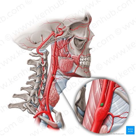 Carotid Anatomy Diagram