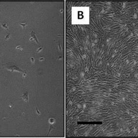 Blastema cell culture. A) At primary culture, varying cell morphologies ...