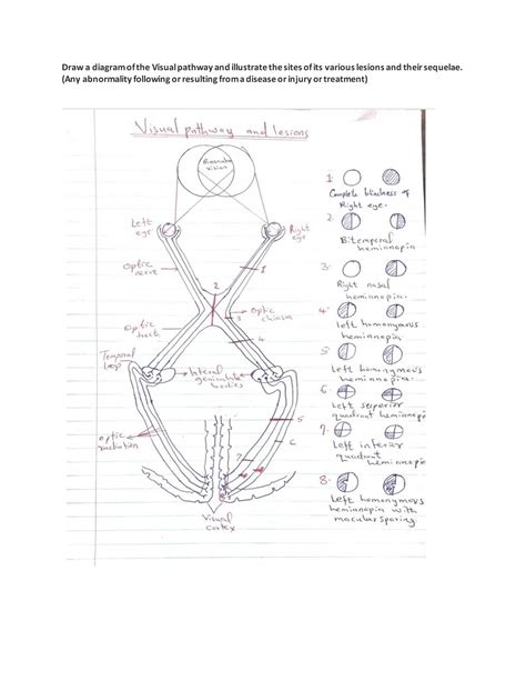 Anatomy assignment (Visual pathway) - Draw a diagram of the Visual ...