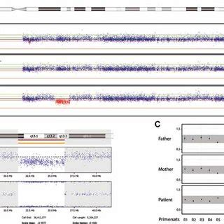 A: SNP array data from the patient and her parents showing a deletion... | Download Scientific ...