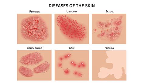 Your homeopathic guide to healthy skin | Dr Batra’s™